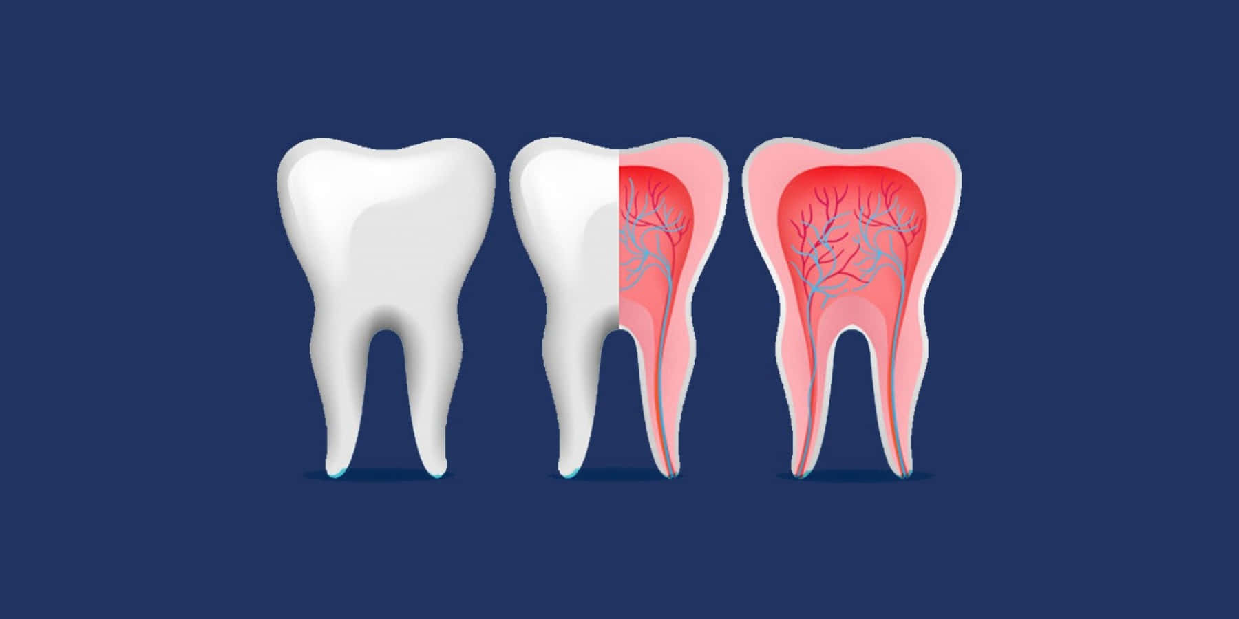 Cariesdental Y Descomposición Dental