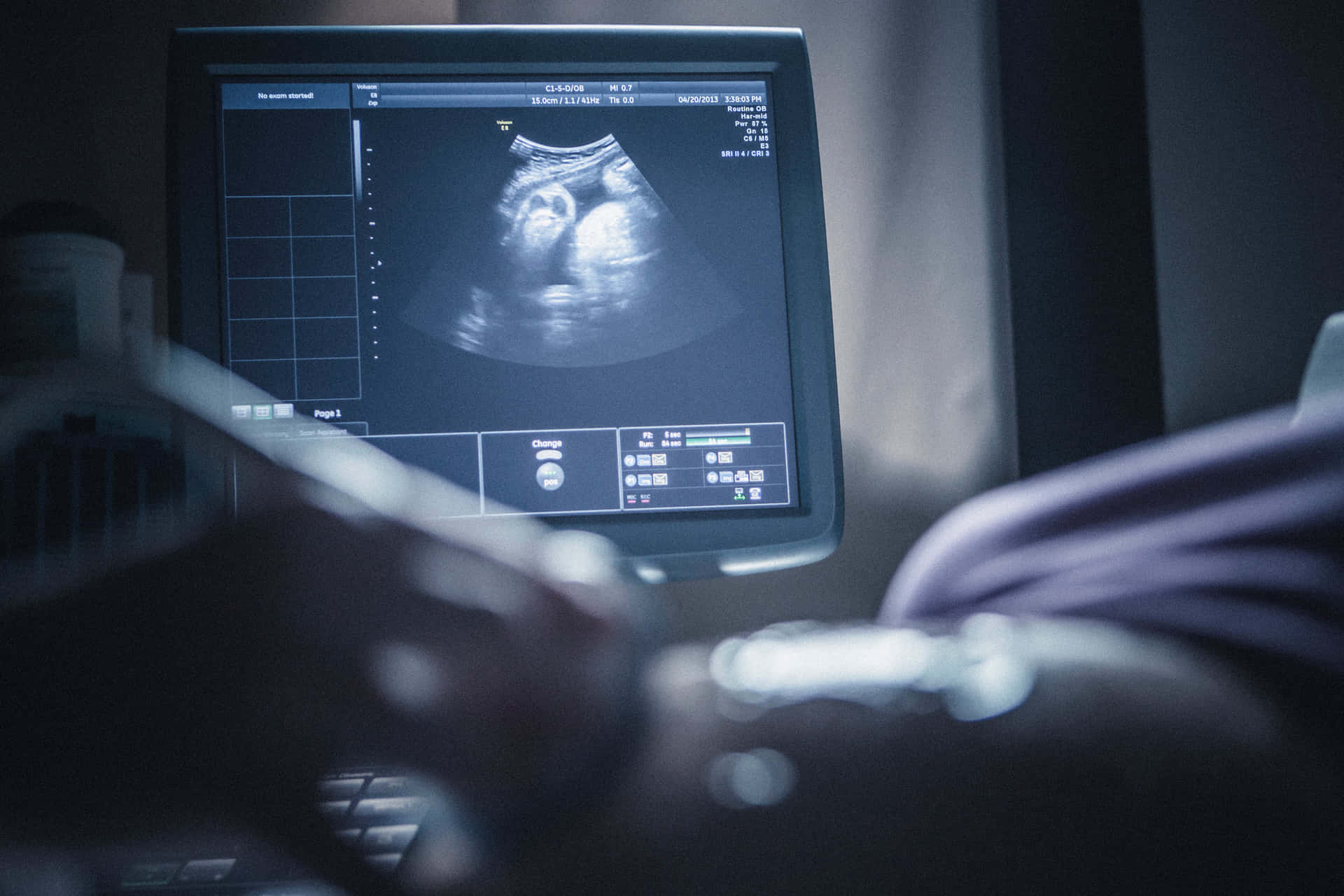 Et billede af en ultralydsscanning af et foster i livmoderen.
