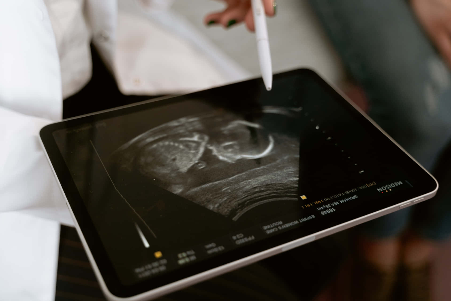 Reveal your baby's unique identity with ultrasound imaging