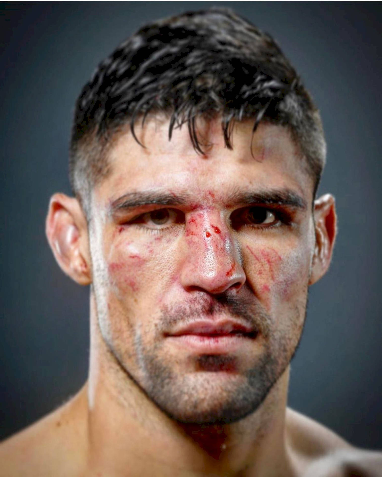 Vicente Luque With Face Injuries Wallpaper