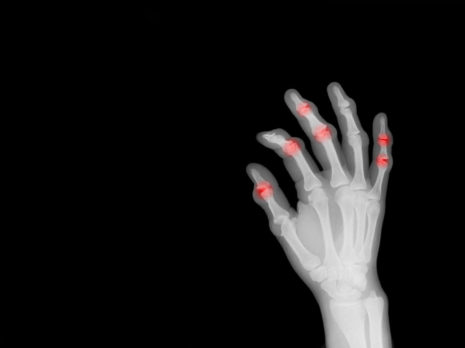 Unamano Con Una Radiografia Che Mostra Un Dito Con Una Macchia Rossa Sfondo