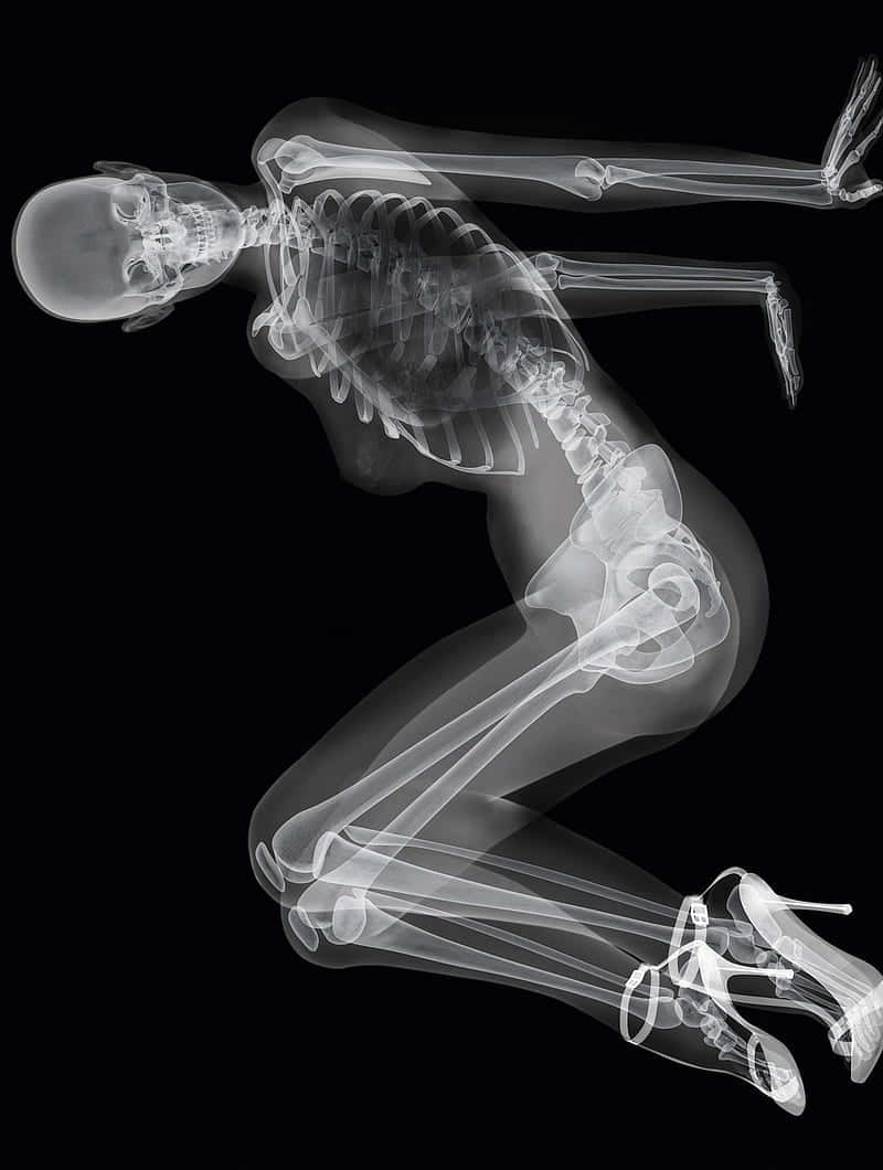 X Ray of a Skeleton Wallpaper