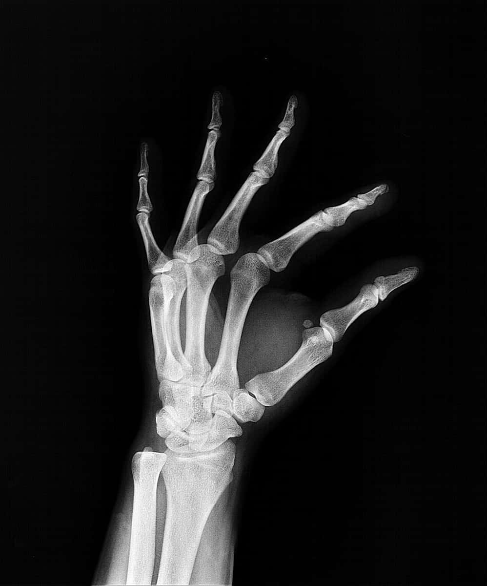 A Black And White Image Of A Hand With A Skeleton Wallpaper