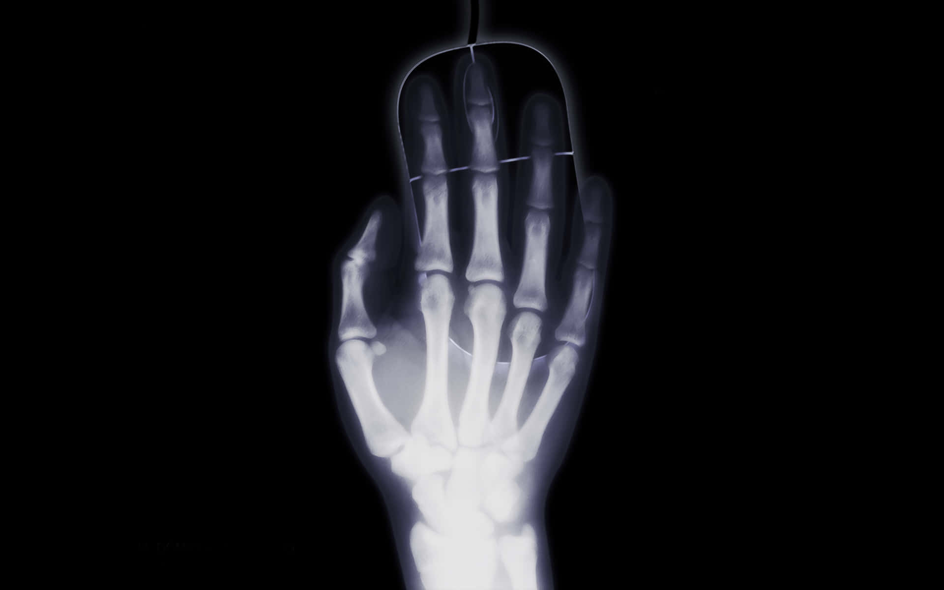 A Closeup X Ray Image of a Human Hand Wallpaper
