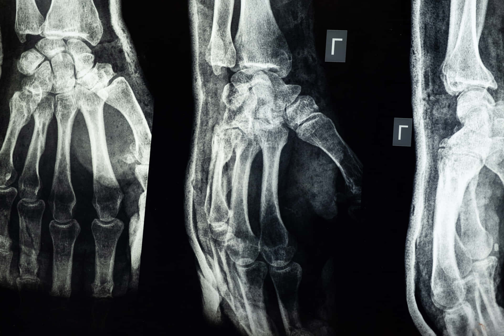 X - Rays Of The Hand And Wrist Wallpaper