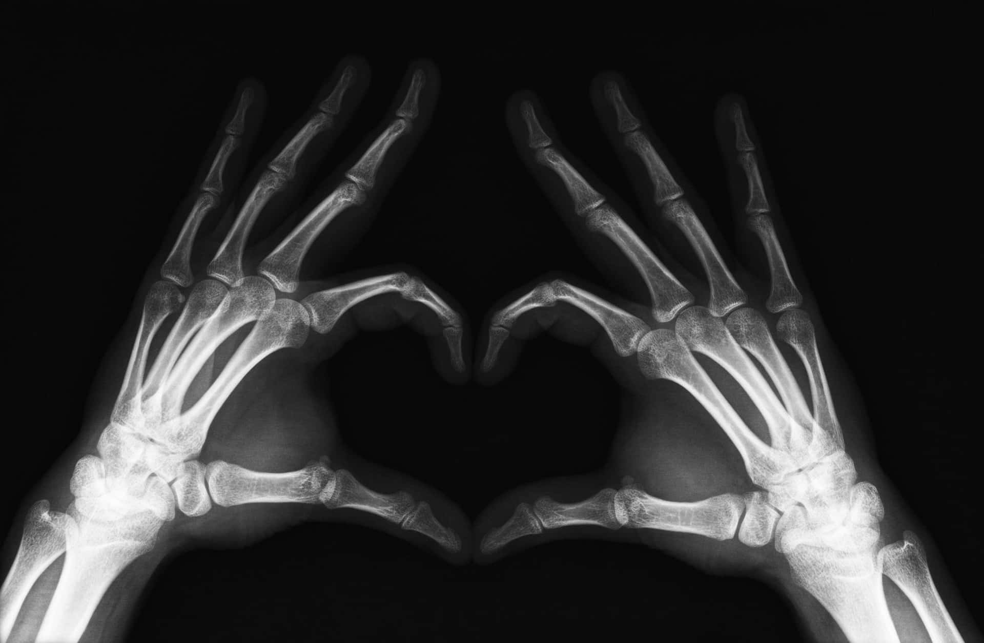 Hands Making A Heart Shape In Black And White Photo
