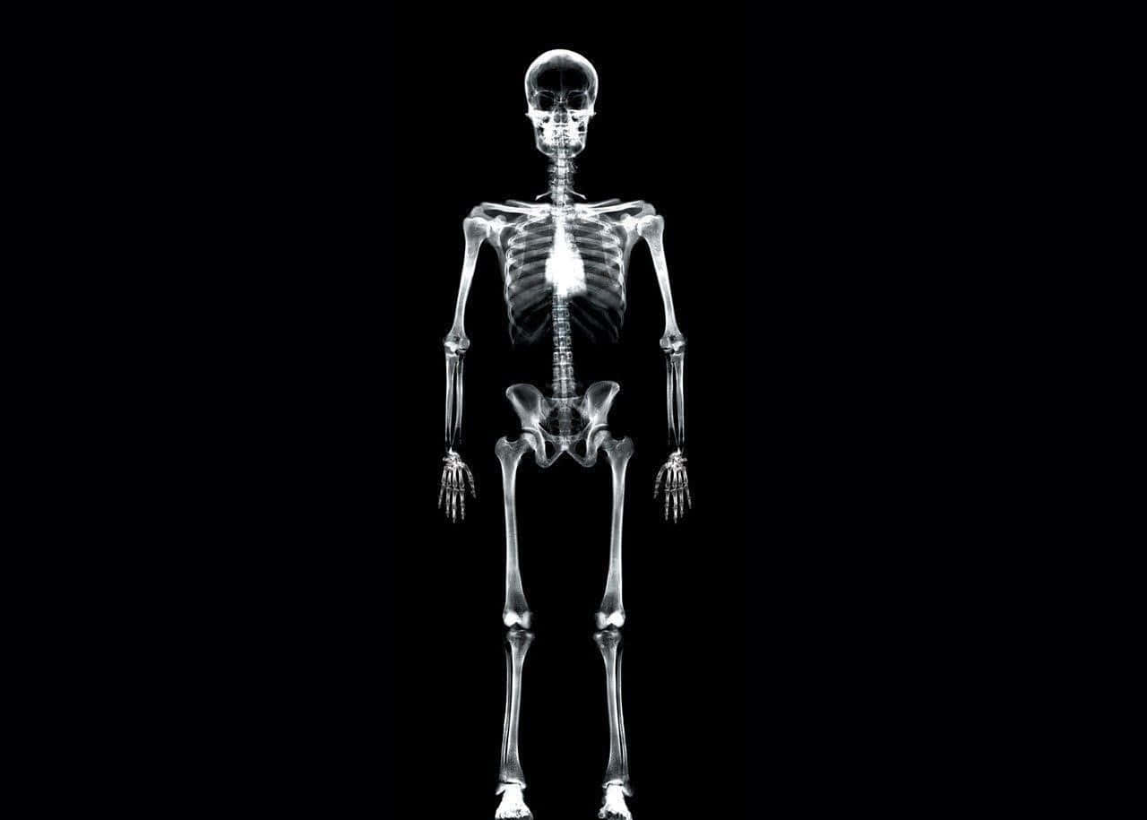 A Skeleton Is Shown On A Black Background