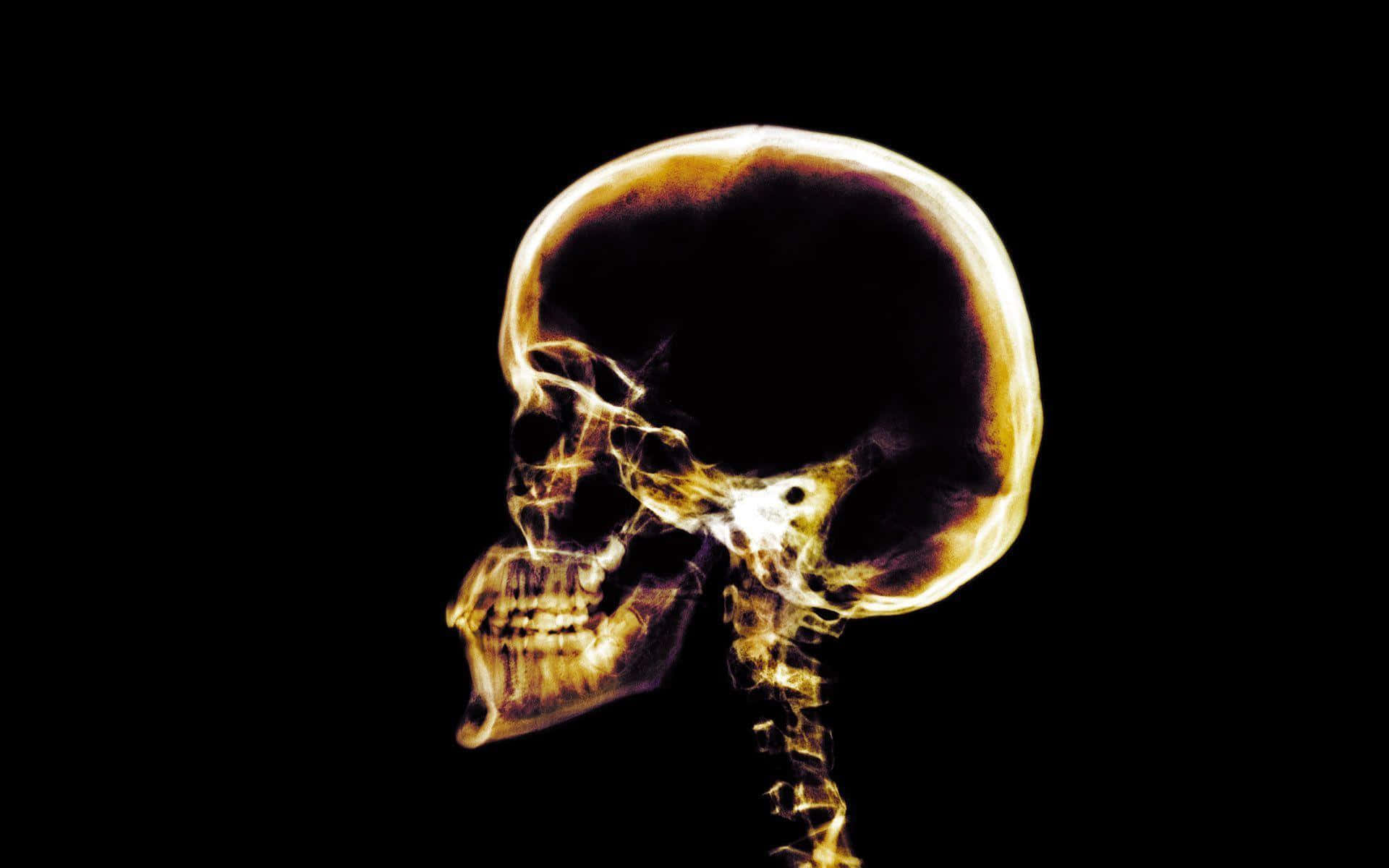 Un'immaginea Raggi X Di Un Cranio Umano