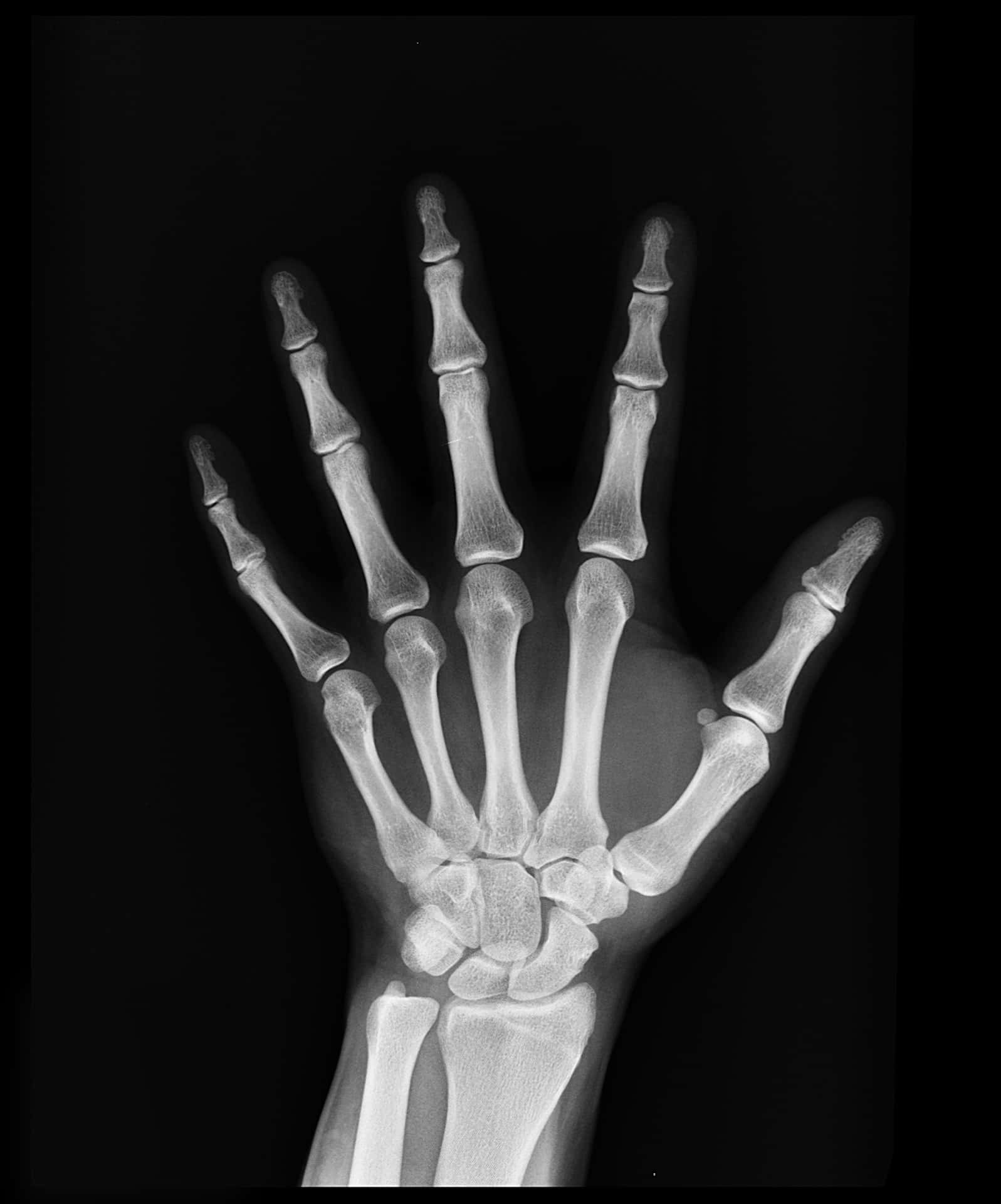 En hånd med et skeletter i det Wallpaper