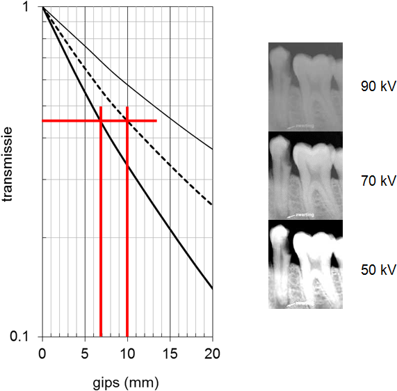 Xray Transmission Graphand Dental Imaging Comparison PNG