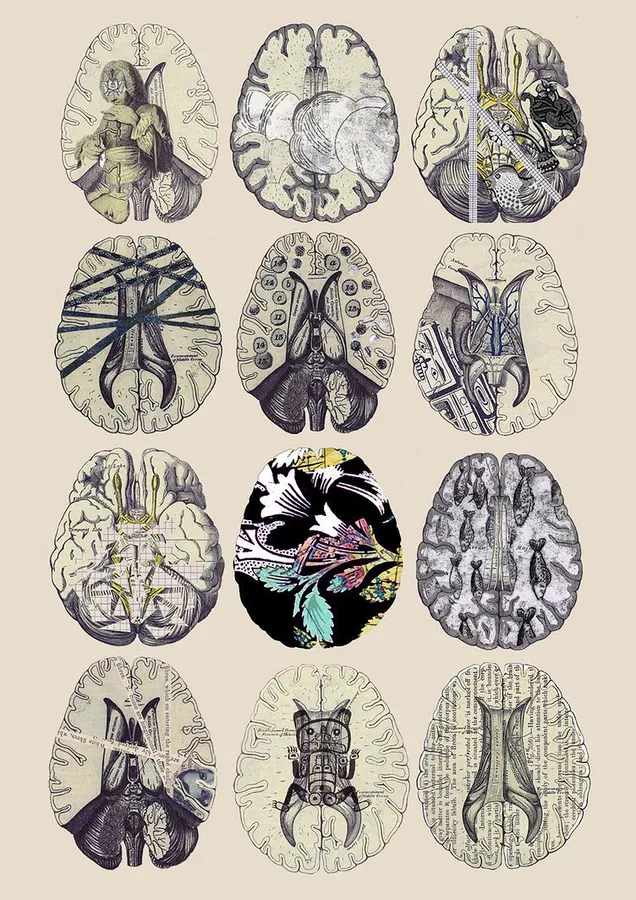 Brain [picture]