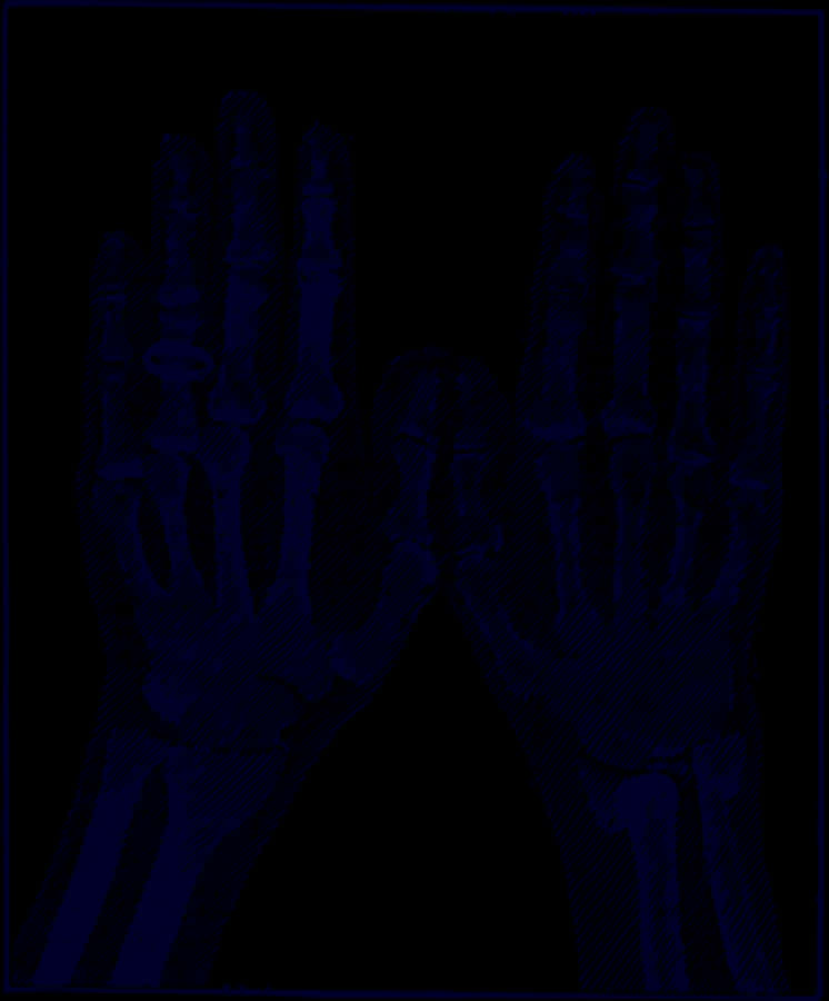 Xray Hands Bones Outline