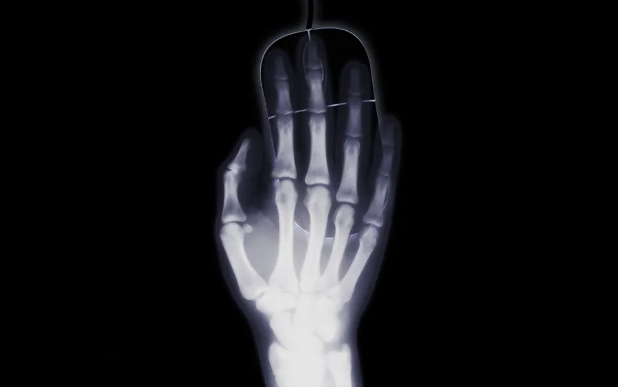 X Ray