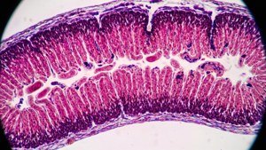 Mikroskopisk histologisk præparat af tyndtarm med H&E-farvning.