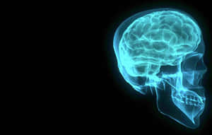 X-ray view of a glowing blue human skull and brain.